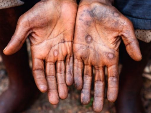 Article dans Sciences et Avenir « MPOX : à la recherche de l&rsquo;animal réservoir »